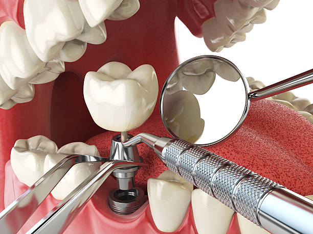 Best Emergency Dental Extractions in Conehatta, MS